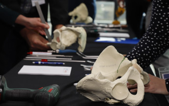 Son Espases acull un curs internacional sobre malalties relacionades amb el maluc en els pacients pediàtrics