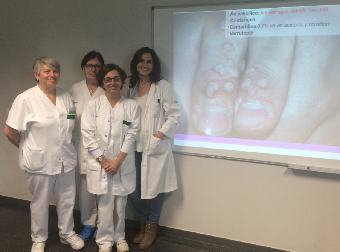 Esta imagen ilustra que: El Servei de Dermatologia organitza un taller per a pediatres i infermers d’atenció primària sobre el tractament de berrugues i mol·luscos contagiosos