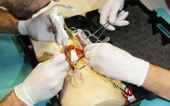 El Servicio de Cirugía Vascular opera unos cincuenta pacientes al año para prevenir los ictus