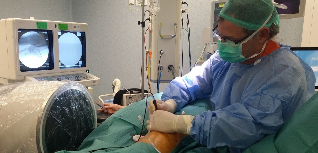 Esta imagen ilustra que: Traumatología de Son Espases aplica una técnica quirúrgica de radiofrecuencia para eliminar el dolor en las rodillas con osteoartritis