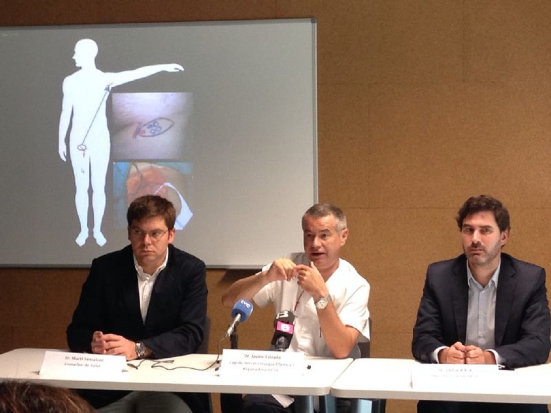 Esta imagen ilustra que: El Servicio de Cirugía Plástica ha realizado la primera intervención de linfedema en las Islas Baleares