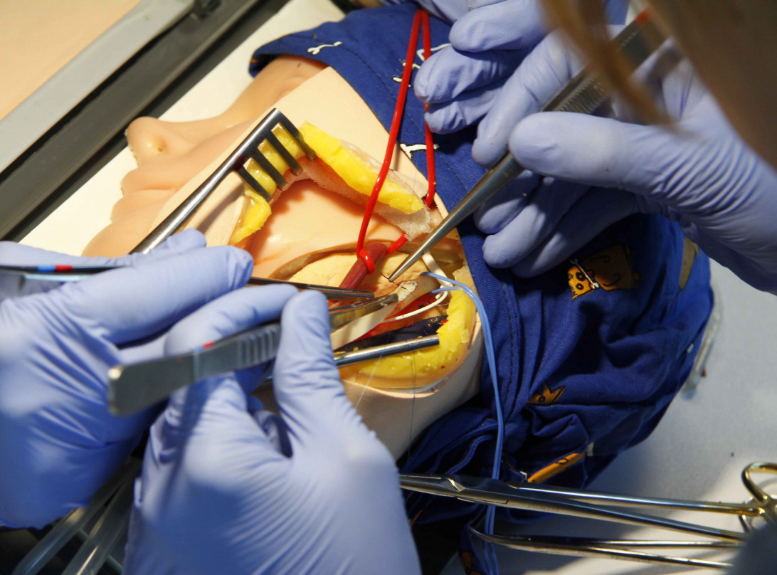 Esta imagen ilustra que: Son Espases realitza un centenar d’intervencions a l’any per prevenir l’ictus