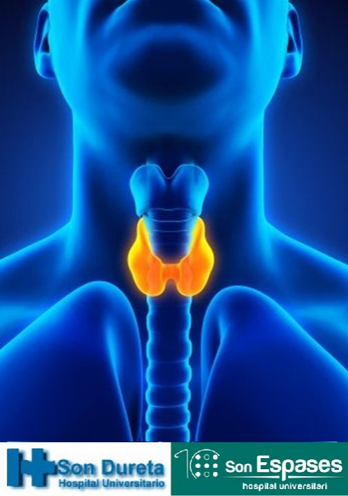 Sesión de Endocrinología: "20 años de cáncer de tiroides en Baleares"