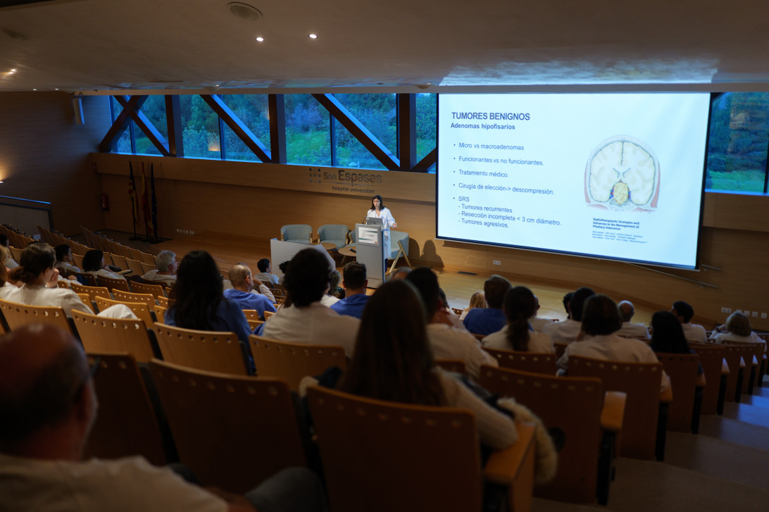 Esta imagen ilustra que: Son Espases consolida el programa de radiocirurgia cerebral després d’un any d’haver-lo implantat