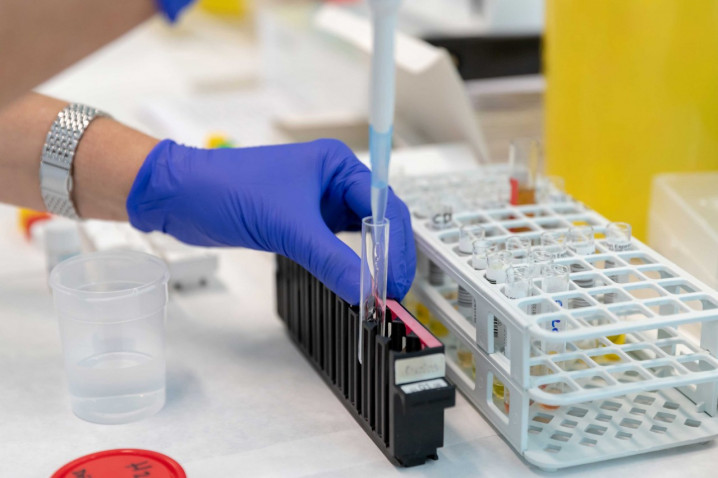 Las Illes Balears ponen en marcha el programa FOCUS para reforzar el cribado oportunista del VIH y la hepatitis C